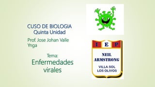CUSO DE BIOLOGIA
Quinta Unidad
Prof. Jose Johan Valle
Ynga
Tema:
Enfermedades
virales
 