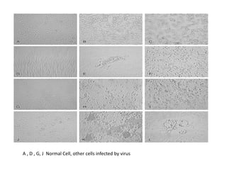A , D , G, J Normal Cell, other cells infected by virus
 
