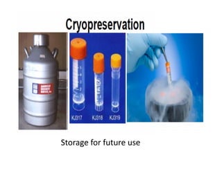 Storage for future use
 