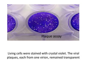 Plaque assay
Living cells were stained with crystal violet. The viral
plaques, each from one virion, remained transparent
 
