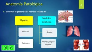Anatomía Patológica.
 Es común la presencia de necrosis focales de:
6
Hígado.
Testículos.
Pulmones.
Nódulos
linfáticos.
Ovarios.
Riñones y órganos
linfoides.
 