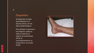 z
Diagnóstico
El diagnóstico se basa
esencialmente en el
decurso clínico y en los
datos epidemiológicos.
Para distinguir el genoma o
los antígenos virales se
utiliza la reacción en
cadena de la polimerasa
(PCR), la
inmunofluorescencia, la
histoquímica o la prueba
ELISA
 