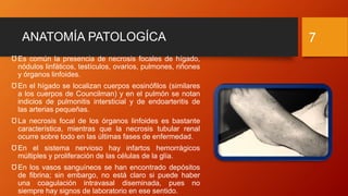 ANATOMÍA PATOLOGÍCA
Ʊ Es común la presencia de necrosis focales de hígado,
nódulos linfáticos, testículos, ovarios, pulmones, riñones
y órganos linfoides.
ƱEn el hígado se localizan cuerpos eosinófilos (similares
a los cuerpos de Councilman) y en el pulmón se notan
indicios de pulmonitis intersticial y de endoarteritis de
las arterias pequeñas.
Ʊ La necrosis focal de los órganos linfoides es bastante
característica, mientras que la necrosis tubular renal
ocurre sobre todo en las últimas fases de enfermedad.
Ʊ En el sistema nervioso hay infartos hemorrágicos
múltiples y proliferación de las células de la glía.
Ʊ En los vasos sanguíneos se han encontrado depósitos
de fibrina; sin embargo, no está claro si puede haber
una coagulación intravasal diseminada, pues no
siempre hay signos de laboratorio en ese sentido.
7
 
