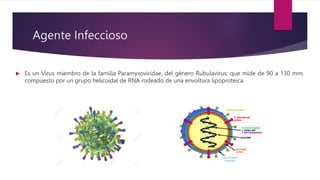 Agente Infeccioso
 Es un Virus miembro de la familia Paramyxoviridae, del género Rubulavirus; que mide de 90 a 130 mm,
compuesto por un grupo helicoidal de RNA rodeado de una envoltura lipoproteica.
 