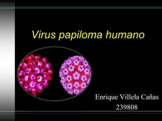 Virus papiloma humano




           Enrique Villela Cañas
                 239808
 