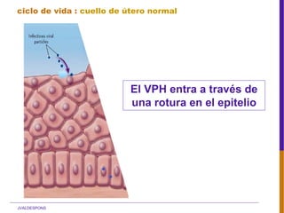 JVALDESPONS
El VPH entra a través de
una rotura en el epitelio
ciclo de vida : cuello de útero normal
 