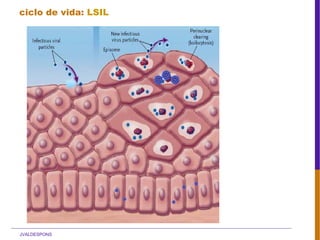 JVALDESPONS
ciclo de vida: LSIL
 