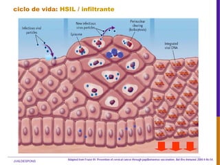 JVALDESPONS
Adapted from Frazer IH. Prevention of cervical cancer through papillomavirus vaccination. Nat Rev Immunol. 2004;4:46–54.
ciclo de vida: HSIL / infiltrante
 