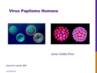 JVALDESPONS
Virus Papiloma Humano
Joura et al. Lancet. 2007
Javier Valdés Pons
 