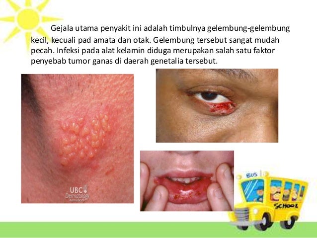 Contoh Hewan Mamalia Yang Merugikan - The Exceptionals