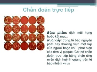 Chẩn đoán trực tiếp
Bệnh phẩm: dịch mũi họng
hoặc kết mạc..
Nuôi cấy: trong tế bào nguyên
phát hay thường trực một lớp
của người hoặc khỉ , phát hiện
các đơn vị plaque. Có thể chẩn
đoán trực tiếp bằng phản ứng
miễn dịch huỳnh quang trên tế
bào nhiễm virus
 
