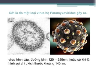 Sởi là do một loại virus họ Paramyxoviridae gây ra.
virus hình cầu, đường kính 120 – 250nm. hoặc có khi là
hình sợi chỉ , kích thước khoảng 140nm.
 