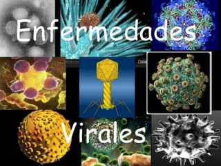 ENFERMEDADES VIRALES
 