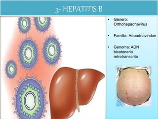 3- HEPATITIS B
• Género:
Orthohepadnavirus
• Familia: Hepadnavindae
• Genoma: ADN
bicatenario
retrotranscrito
 