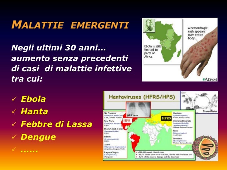 Dovè migliore per aumentare un petto in SPb