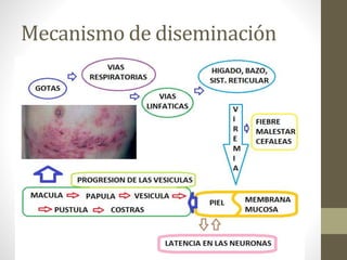 Mecanismo de diseminación
 