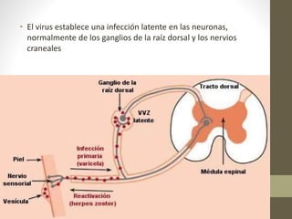 • El virus establece una infección latente en las neuronas,
normalmente de los ganglios de la raíz dorsal y los nervios
craneales
 