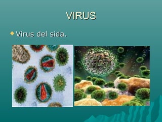 VIRUS
 Virus   del sida.
 