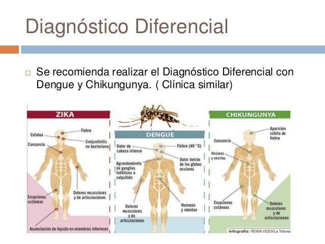 Virus zika