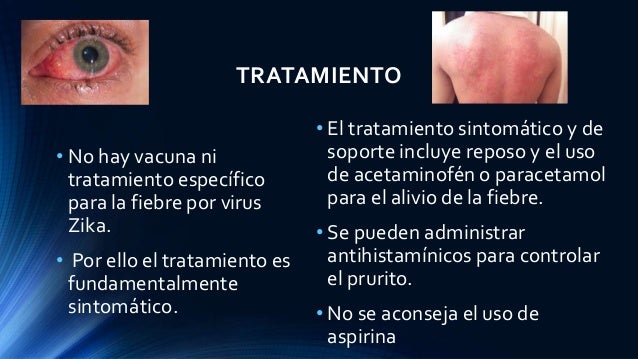 Virus zika 2 Virus zika 2