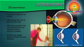  Características
 Problema na superfície da
córnea.
 Não enxerga bem nem de
perto nem de longe.
 Não tem percepção nítida
dos contrastes entre as
linhas horizontais,
verticais e oblíquas.
• Distorção da imagem
devido à difusão dos raios
luminosos
 