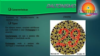  Características
Problema no reconhecimento de
algumas cores.
 Tipos
Em número menor, existem daltônicos
que confundem o azul (Tritanopia) e o
amarelo.
Deuteranopia em que a pessoa não
distingue a tonalidade verde.
Protanopia onde a pessoa não
distingue a tonalidade vermelha.
(TESTE)
 