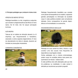 Patologia frequentemente hereditária que consiste
numa perda da transparência do cristalino, originando
grandes perturbações na diminuição da acuidade
visual. A visão periférica também está normalmente
afectada. Como consequência há grande depen-
dência na funcionalidade e na autonomia.
DEGENERESCÊNCIA MACULAR
Patologia da zona central da retina, mácula, e que
constitui uma das causas mais frequentes de
dependência visual ligada à idade.
Outras patologias com a mesma sintomatologia,
podem surgir em escalões etários mais jovens (ex:
queimadura da mácula - eclipse solar).
A visão periférica não sofre alterações pelo que não
há problemas na mobilidade. A visão central é
afectada por escotomas que podem progredir.
4. Principais patologias que conduzem à baixa visão
ATROFIA DO NERVO ÓPTICO
Patologia hereditária, ou não, congénita ou adquirida
que consiste na degenerescência das fibras do nervo
óptico. Se for total, não há sequer percepção
luminosa.
ALTA MIOPIA
Trata-se de um defeito de refracção elevado (≥ a 6
dioptrias), que frequentemente é hereditário,
associado a outros aspectos degenerativos. O risco
de descolamento de retina é elevado, devendo ser
tomadas as precauções necessárias.
CATARATAS CONGÉNITAS
24
 