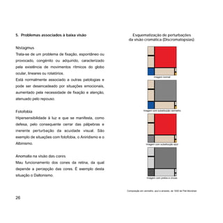 Esquematização de perturbações
da visão cromática (Discromatopsias):
5. Problemas associados à baixa visão
Nistagmus
Trata-se de um problema de fixação, espontâneo ou
provocado, congénito ou adquirido, caracterizado
pela existência de movimentos rítmicos do globo
ocular, lineares ou rotatórios.
Está normalmente associado a outras patologias e
pode ser desencadeado por situações emocionais,
aumentado pela necessidade de fixação e atenção,
atenuado pelo repouso.
Fotofobia
Hipersensibilidade à luz e que se manifesta, como
defesa, pelo consequente cerrar das pálpebras e
inerente perturbação da acuidade visual. São
exemplo de situações com fotofobia, o Aniridismo e o
Albinismo.
Anomalia na visão das cores
Mau funcionamento dos cones da retina, da qual
depende a percepção das cores. É exemplo desta
situação o Daltonismo.
26
Imagem normal
Imagem com substituição vermelho
Imagem com substituição azul
Imagem com pretos e cinzas
Composição em vermelho, azul e amarelo, de 1930 de Piet Mondrian
 