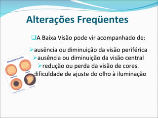 Alterações Freqüentes  A Baixa Visão pode vir acompanhado de: ausência ou diminuição da visão periférica ausência ou diminuição da visão central redução ou perda da visão de cores. dificuldade de ajuste do olho à iluminação  