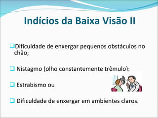 Indícios da Baixa Visão II Dificuldade de enxergar pequenos obstáculos no chão; Nistagmo (olho constantemente trêmulo); Estrabismo ou Dificuldade de enxergar em ambientes claros.  