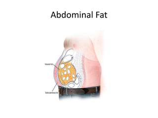 Abdominal Fat
 