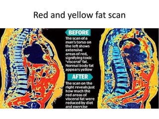 Red and yellow fat scan
 