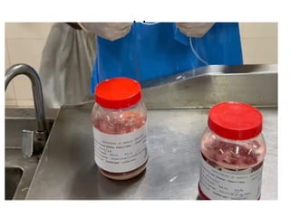 viscera packing-compressed of human beings | PPTX