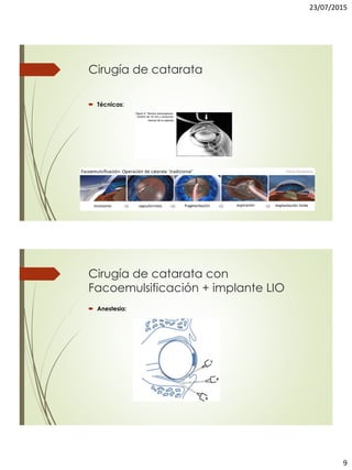23/07/2015
9
Cirugía de catarata
 Técnicas:
Cirugía de catarata con
Facoemulsificación + implante LIO
 Anestesia:
 