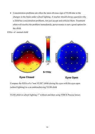 visual dyslexia, visual dyspraxia and other vision linked stress | PDF