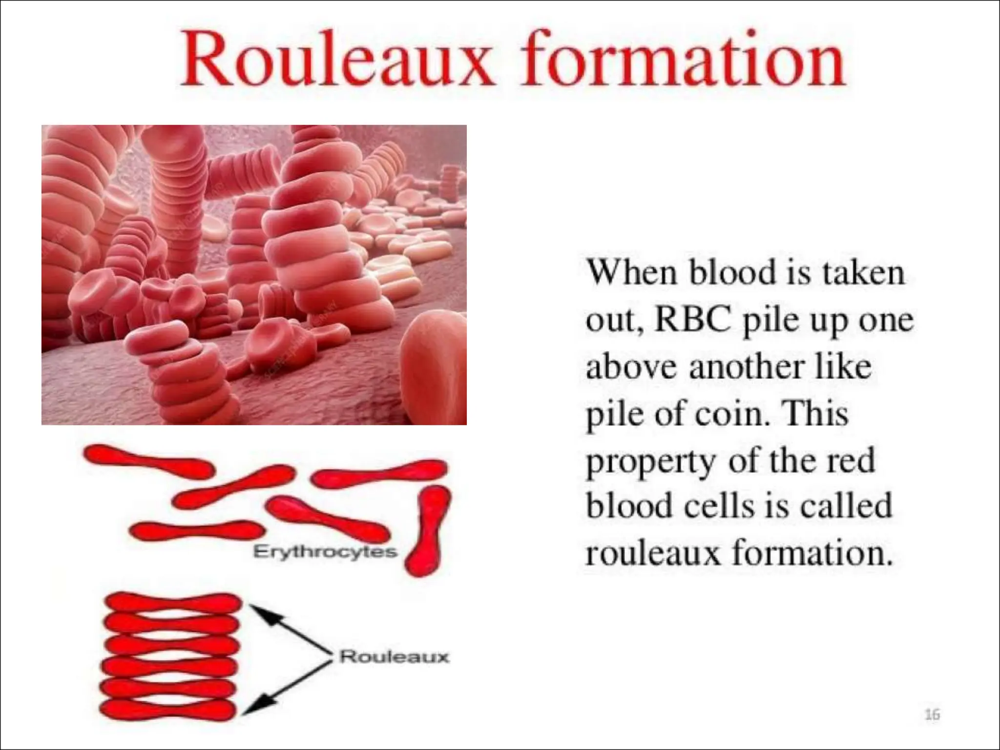 METHODS OF EVALUATION OF ESR AND ITS CLINICAL SIGNIFICANCE | PPTX