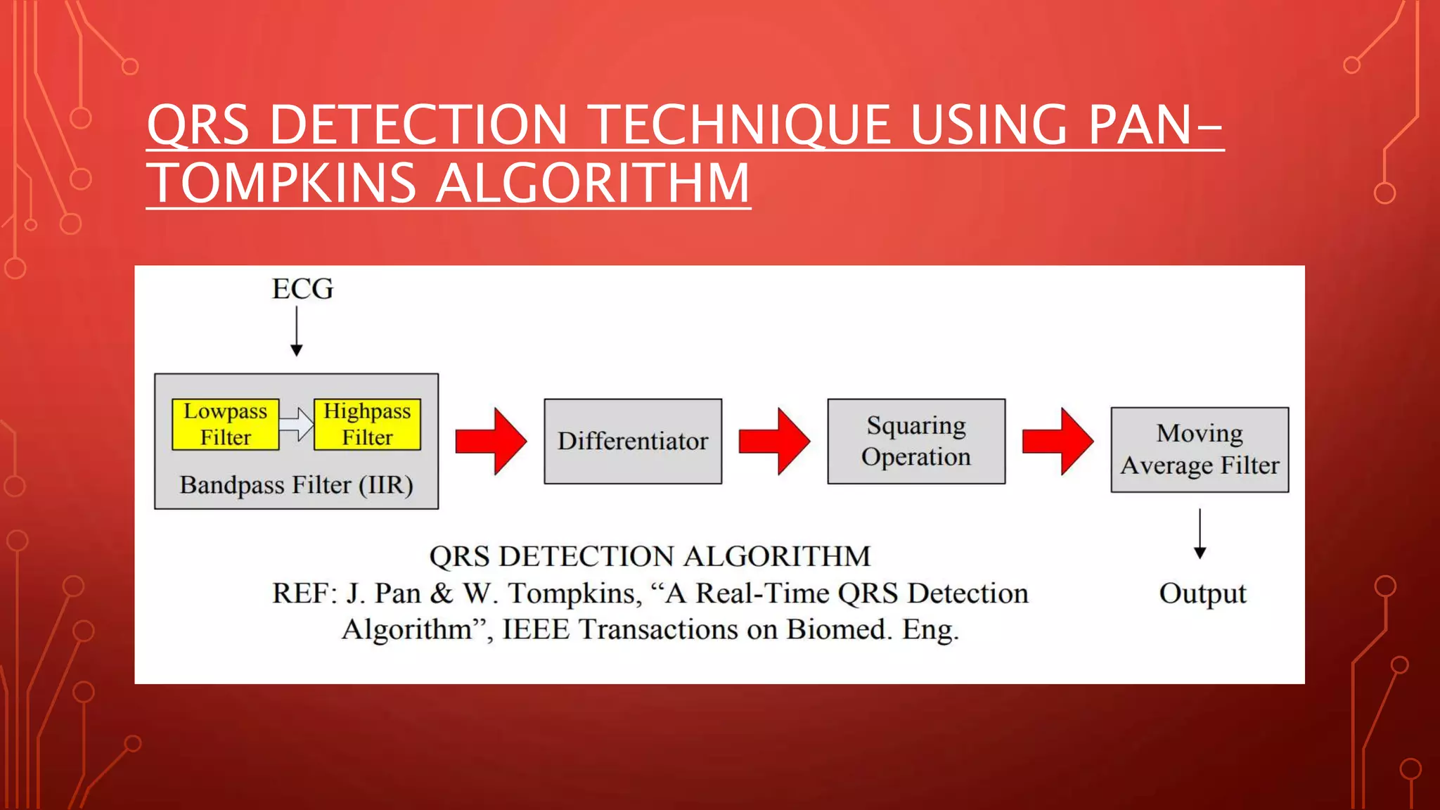 QRS DETECTION TECHNIQUE USING PAN-
TOMPKINS ALGORITHM
 