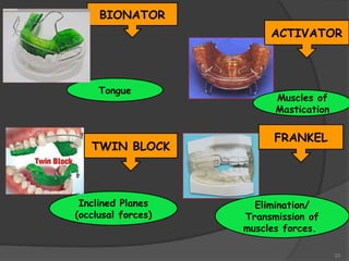 22
BIONATOR
Tongue
ACTIVATOR
Muscles of
Mastication
FRANKEL
Elimination/
Transmission of
muscles forces.
TWIN BLOCK
Inclined Planes
(occlusal forces)
 