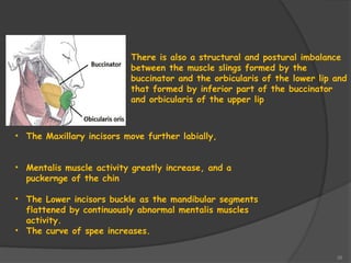 38
There is also a structural and postural imbalance
between the muscle slings formed by the
buccinator and the orbicularis of the lower lip and
that formed by inferior part of the buccinator
and orbicularis of the upper lip
• The Maxillary incisors move further labially,
• Mentalis muscle activity greatly increase, and a
puckernge of the chin
• The Lower incisors buckle as the mandibular segments
flattened by continuously abnormal mentalis muscles
activity.
• The curve of spee increases.
 