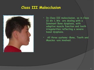 41
Class III Malocclusion
• In Class III malocclusion, as in Class
II div 1,We are dealing with a
Dominant Bone dysplasia, with
adaptive muscle function and tooth
irregularities reflecting a severe
basal dysplasia.
• All three systems –Bone, Teeth and
Muscles –are involved.
 