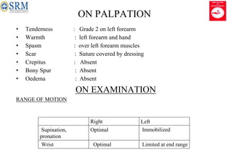 VISHNU VARDHAN S MPT19415 1st case..pptx