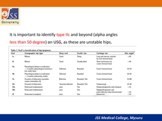 JSS Medical College, Mysuru
It is important to identify type IIc and beyond (alpha angles
less than 50 degree) on USG, as these are unstable hips.
 