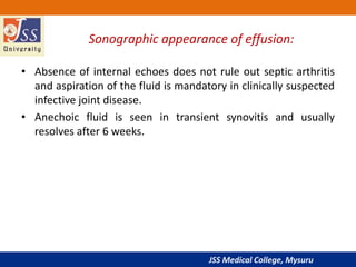 JSS Medical College, Mysuru
Sonographic appearance of effusion:
• Absence of internal echoes does not rule out septic arthritis
and aspiration of the fluid is mandatory in clinically suspected
infective joint disease.
• Anechoic fluid is seen in transient synovitis and usually
resolves after 6 weeks.
 