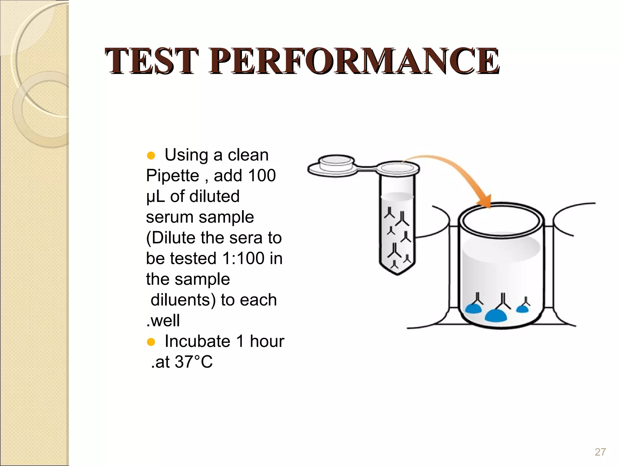 TEST PERFORMANCE

   Using a clean
 Pipette , add 100
 µL of diluted
 serum sample
 (Dilute the sera to
 be tested 1:100 in
 the sample
  diluents) to each
 .well
  Incubate 1 hour
  .at 37°C




                       27
 