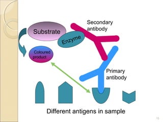 Secondary
                        antibody
Substrate
                    e
            Enzym
 Coloured
product


                              Primary
                              antibody




       Different antigens in sample
                                         15
 