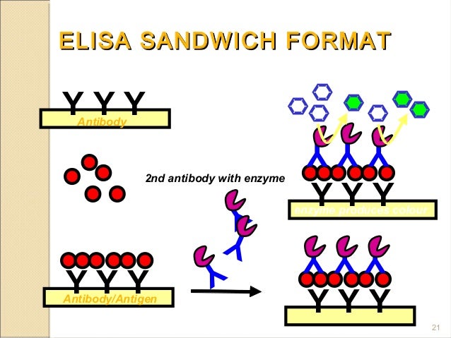 elisa and ria Download/view the pdf radioimmunoassay (ria), and enzyme-linked immunosorbent assay (elisa), and competitive inhibition assay radioimmunoassay (ria) and enzyme. elisa and ria Download/view the pdf radioimmunoassay (ria), and enzyme-linked immunosorbent assay (elisa), and competitive inhibition assay radioimmunoassay (ria) and enzyme.