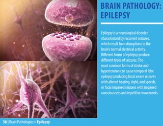 36 | Brain Pathologies> Epilepsy
Epilepsy is a neurological disorder
characterized by recurrent seizures,
which result from disruptions to the
brain’s normal electrical activity.
Different forms of epilepsy produce
different types of seizures.The
most common forms of stroke and
hypertension can cause temporal lobe
epilepsy producing focal aware seizures
with altered hearing, sight, and speech,
or focal impaired seizures with impaired
consciousness and repetitive movements.
BRAIN PATHOLOGY:
EPILEPSY
 