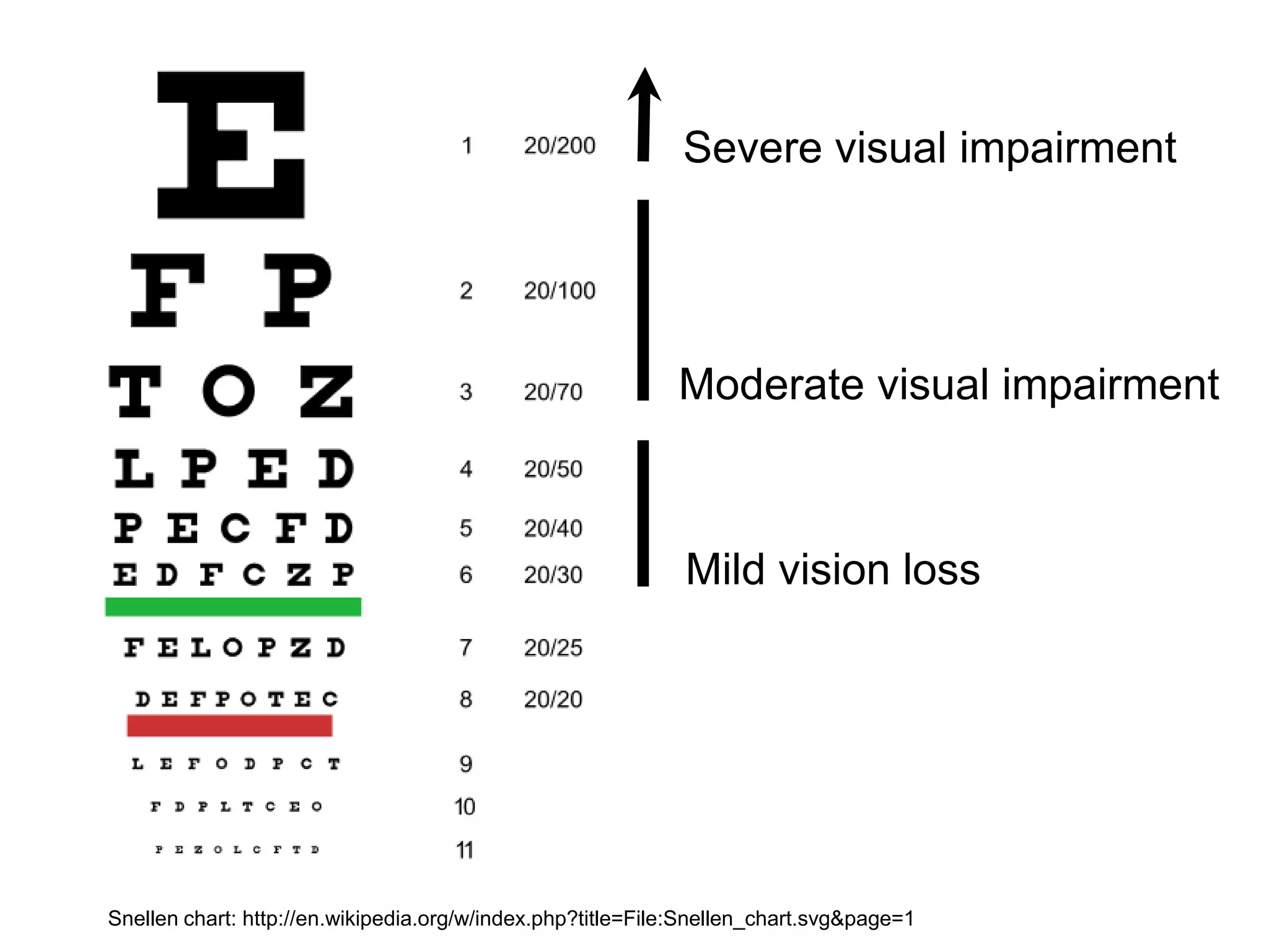 Severe visual impairment




                                                            Moderate visual impairment



                                                             Mild vision loss




Snellen chart: http://en.wikipedia.org/w/index.php?title=File:Snellen_chart.svg&page=1
 