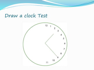 Visual Clock Draw Test Visioary ophthalmology tbi presentation 9.7.14