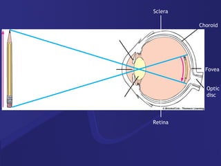 Sclera Choroid Fovea Optic disc Lens Retina Pupil Iris 
